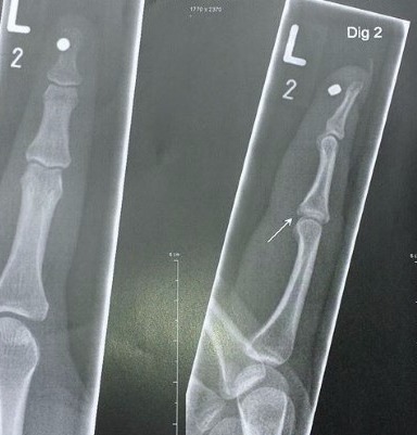 Magnet Implantat Bodymodificationangebot in Deutschland: Cutting, Implantate, Beadings Zungenspaltung sowie Piercing Ausbildung, Piercer werden, Piercing Kurs, Piercer Seminar und Bodymods lernen auf piercen-lernen.de Magnet Implantat Bodymodificationangebot in Deutschland: Cutting, Implantate, Beadings Zungenspaltung sowie Piercing Ausbildung, Piercer werden, Piercing Kurs, Piercer Seminar und Bodymods lernen auf piercen-lernen.de