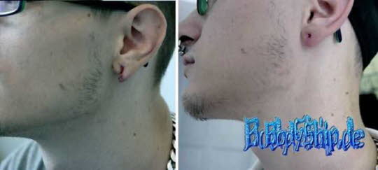 Bodymodification Galerie - professionell bodymodification und piercen-lernen