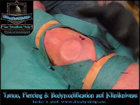 Bodymodification Galerie - professionell bodymodification und piercen-lernen