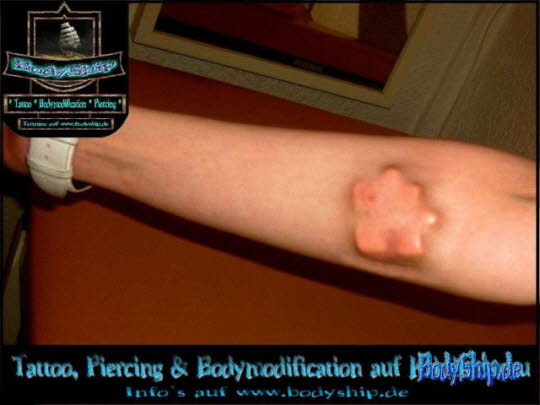 Bodymodification Galerie - professionell bodymodification und piercen-lernen