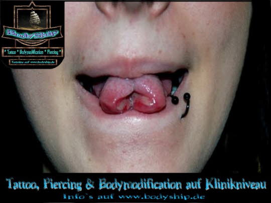 Bodymodification Galerie - professionell bodymodification und piercen-lernen