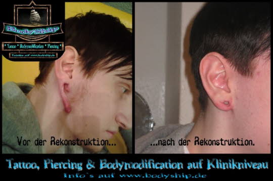 Bodymodification Galerie - professionell bodymodification und piercen-lernen