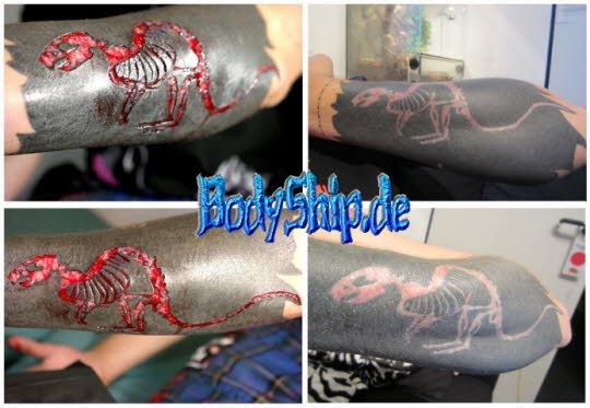 Skelett Cutting Scarifikation Bodymod by Ben - Bodymodification Galerie - professionell bodymodification und piercen-lernen