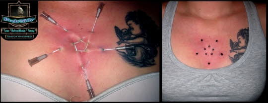 Surface Play Nadeln Needles Star Stern Dekoletee Brust   - Dozent Ben Lucht -professionell bodymodification und piercen-lernen