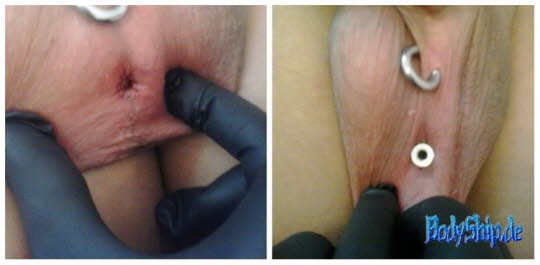 Transcrotal Piercing Tunnel  - Dozent Ben Lucht -professionell bodymodification und piercen-lernen