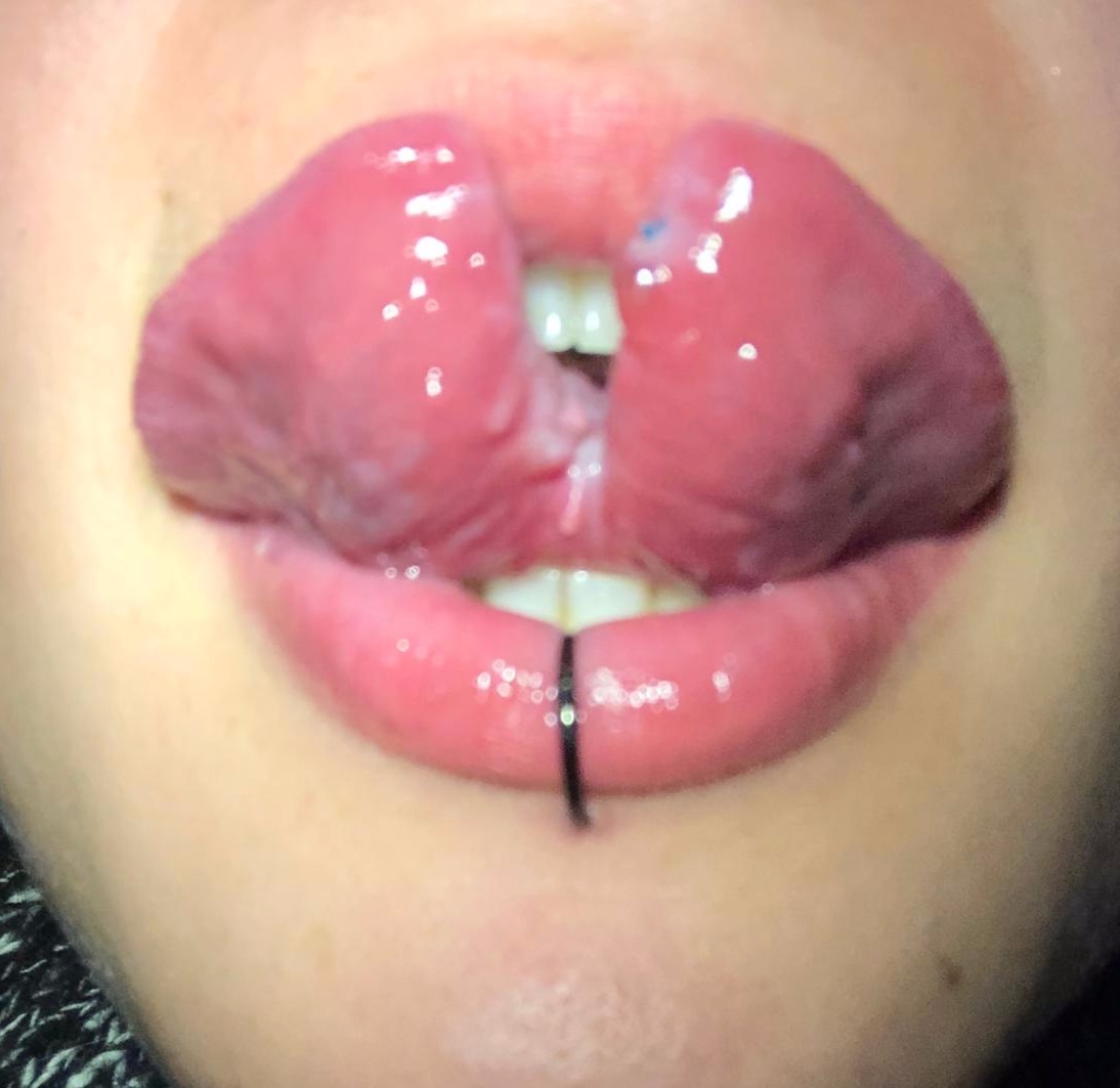 Tongue Split Frau - Zungenspaltung frisch - Cutting, Implantate, Beadings Zungenspaltung sowie Piercing Ausbildung, Piercer werden, Piercing Kurs, Piercer Seminar und Bodymods lernen auf piercen-lernen.de #modsbyben 