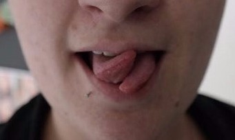 Tongue Split - Zungenspaltung Frau - Cutting, Implantate, Beadings Zungenspaltung sowie Piercing Ausbildung, Piercer werden, Piercing Kurs, Piercer Seminar und Bodymods lernen auf piercen-lernen.de #modsbyben 