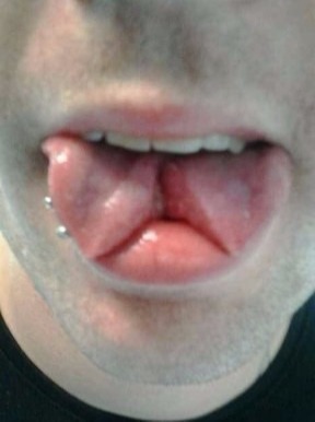 Tongue Split - Zungenspaltung Mann - Cutting, Implantate, Beadings Zungenspaltung sowie Piercing Ausbildung, Piercer werden, Piercing Kurs, Piercer Seminar und Bodymods lernen auf piercen-lernen.de #modsbyben 