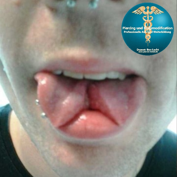 tongue Split Zungenspaltung Zunge schneiden Skalpell Echsenzunge Schlangenzunge Bodymodification Deutschland Ben Lucht piercen und bodymodification lernen #modsbyben